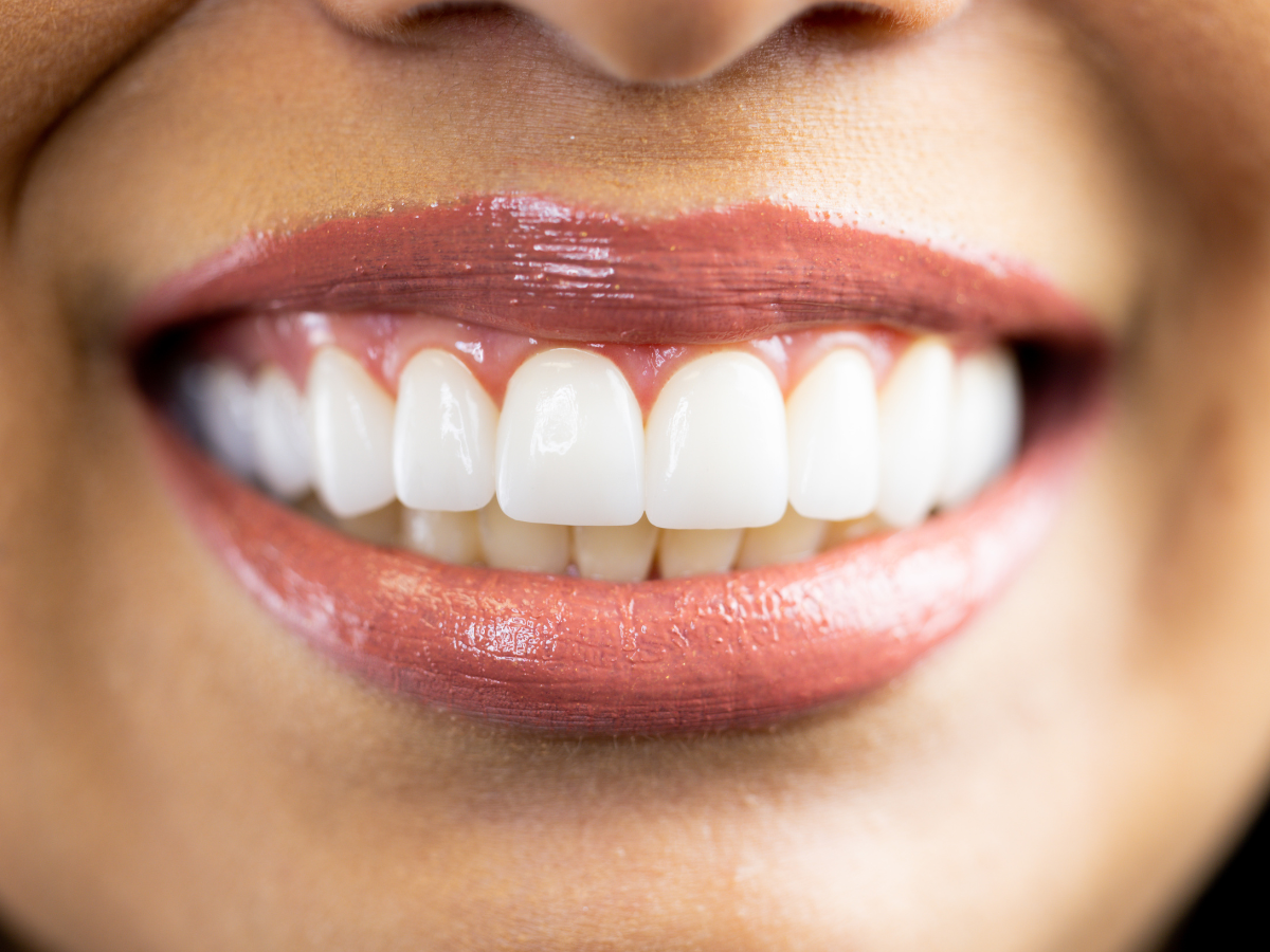 The whitening complex brightens the enamel
