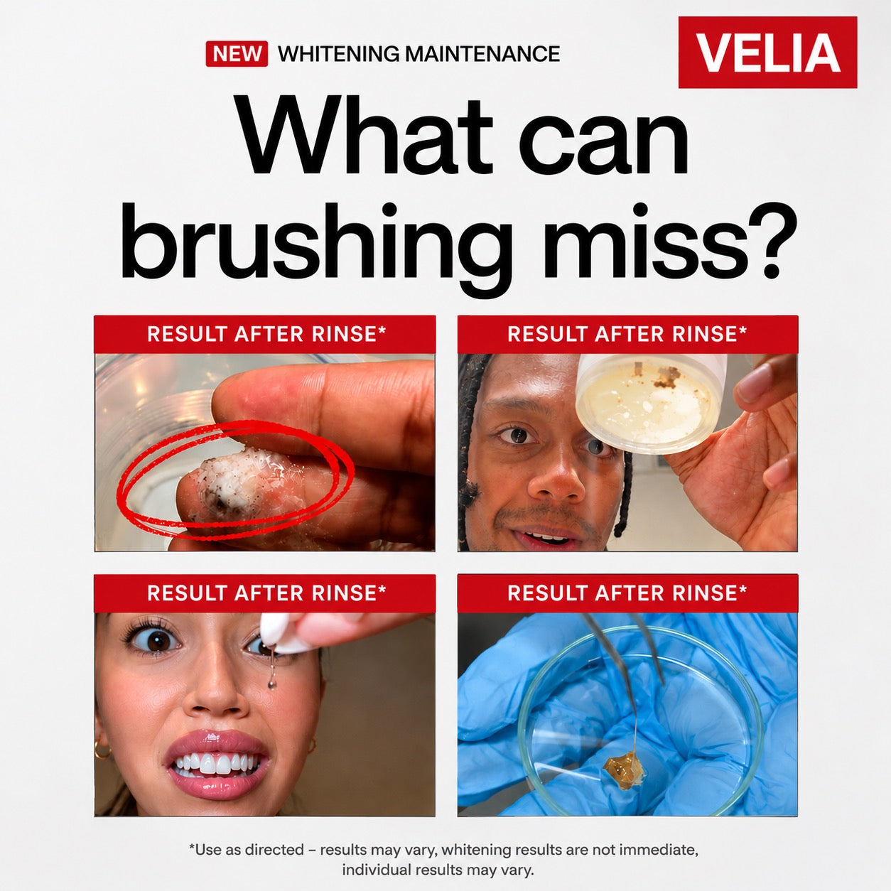 What brushing misses — visible plaque after rinsing with Velia